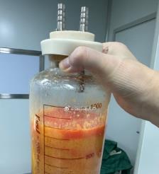 贵港水动力吸脂手术要做多久？